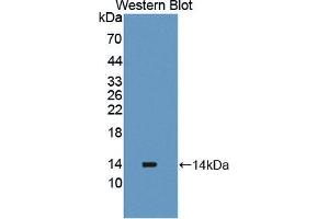 Western blot analysis of the recombinant protein. (PLOD2 Antikörper  (AA 644-737))