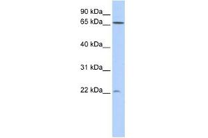 DIRAS1 antibody used at 1 ug/ml to detect target protein.