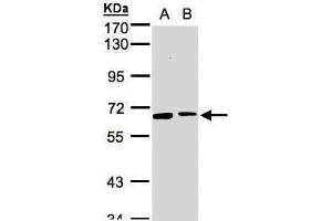 WB Image Sample(30 ug whole cell lysate) A:293T B:MOLT4 , 7. (SENP2 Antikörper  (N-Term))