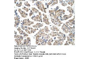 Rabbit Anti-GTPBP9 Antibody  Paraffin Embedded Tissue: Human Muscle Cellular Data: Skeletal muscle cells Antibody Concentration: 4.
