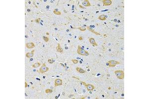 Immunohistochemistry of paraffin-embedded mouse brain using FASTKD1 Antibody (ABIN5975129) at dilution of 1/100 (40x lens). (FASTKD1 Antikörper)