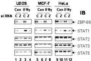 Image no. 1 for anti-Zinc Finger Protein 148 (ZNF148) antibody (ABIN299225) (ZNF148 Antikörper)
