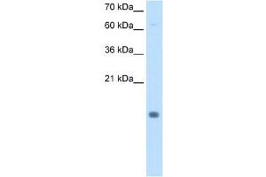 Cystatin B antibody used at 0. (CSTB Antikörper)