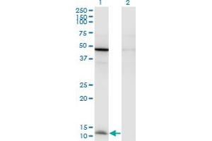 Western Blot analysis of CCL2 expression in transfected 293T cell line by CCL2 monoclonal antibody (M05), clone 1F10. (CCL2 Antikörper  (AA 1-99))