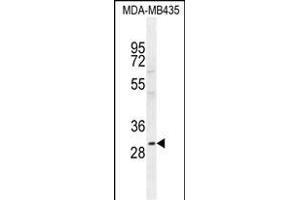 CLEC10A Antibody (N-term) (ABIN654515 and ABIN2844239) western blot analysis in MDA-M cell line lysates (35 μg/lane). (CLEC10A Antikörper  (N-Term))
