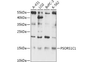 Western blot analysis of extracts of various cell lines, using PSORS1C1 antibody (ABIN7269742) at 1:1000 dilution. (PSORS1C1 Antikörper)