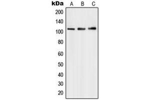 Western blot analysis of PMS1 expression in HepG2 (A), Molt4 (B), A549 (C) whole cell lysates. (PMS1 Antikörper  (Center))