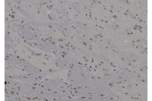 ABIN6265102 and ABIN6277278 at 1/100 staining Rat brain tissue by IHC-P. (SKP1 Antikörper  (Internal Region))