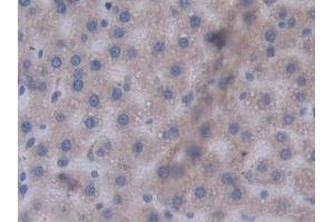 Detection of STAT2 in Rat Liver Tissue using Polyclonal Antibody to Signal Transducer And Activator Of Transcription 2 (STAT2) (STAT2 Antikörper  (AA 587-838))