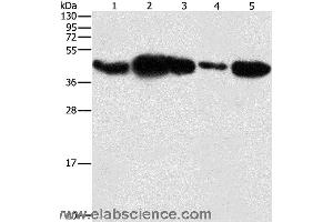 Western blot analysis of HepG2 cell and human fetal placenta tissue, 293T cell and human testis tissue, NIH/3T3 cell, using PGK2 Polyclonal Antibody at dilution of 1:600 (PGK2 Antikörper)