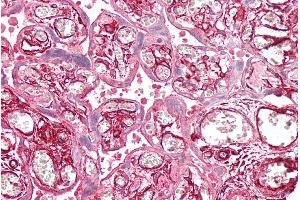 Immunohistochemistry (IHC) image for anti-Tropomyosin 4 (TPM4) (C-Term) antibody (ABIN2613490)