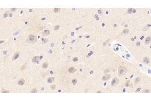 Detection of EFNA3 in Human Cerebrum Tissue using Polyclonal Antibody to Ephrin A3 (EFNA3) (Ephrin A3 Antikörper  (AA 30-238))