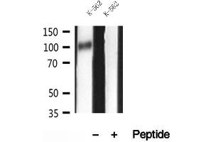 Western blot analysis of extracts of K-562 cells, using GADD34 antibody. (GADD34 Antikörper)