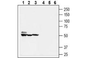 Western blot analysis of mouse brain lysate (lanes 1 and 4), rat kidney membranes (lanes 2 and 5) and mouse colon membranes (3 and 6): - 1-3. (SLC5A8 Antikörper  (C-Term, Intracellular))