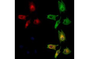 ABIN6260208 and ABIN6273200 staining HUVEC cells by IF/ICC. (BBS10 Antikörper  (Internal Region))