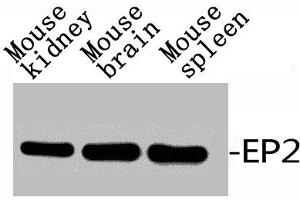 Western Blot analysis of RAT-KIDNEY MOUSE-BRAIN MOUSE-HEART using EP2 Polyclonal Antibody. (PTGER2 Antikörper  (C-Term))