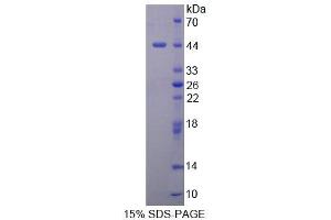 SDS-PAGE analysis of Mouse DHPS Protein. (DHPS Protein)