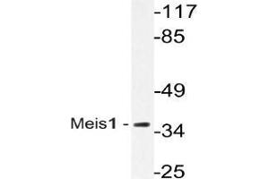 Western blot (WB) analysis of Meis1 antibody in extracts from Jurkat cells. (MEIS1 Antikörper)