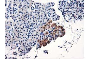 Immunohistochemical staining of paraffin-embedded Human pancreas tissue using anti-TBC1D21 mouse monoclonal antibody. (TBC1D21 Antikörper)