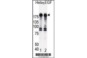 Western blot analysis of EGFR in Hela cell lysates, either induced (Lane 1) or noninduced with EGF (Lane 2). (EGF Antikörper  (AA 1048-1077))