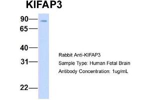 Host: Rabbit  Target Name: KIFAP3  Sample Tissue: Human Fetal Brain  Antibody Dilution: 1. (KIFAP3 Antikörper  (Middle Region))