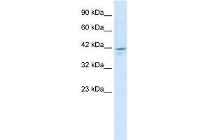 Human HepG2; WB Suggested Anti-ZNF237 Antibody Titration: 1. (ZMYM5 Antikörper  (N-Term))