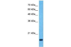 Host:  Rabbit  Target Name:  CCL18  Sample Type:  Fetal Lung lysates  Antibody Dilution:  0. (CCL18 Antikörper  (Middle Region))