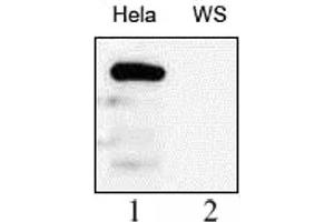 WRN antibody (mAb) tested by Western blot.