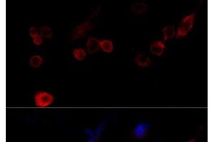 Immunofluorescence analysis of NIH/3T3 cells using FLNA Polyclonal Antibody at dilution of 1:100 (40x lens).