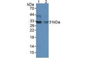 Figure. (DIO2 Antikörper  (AA 30-259))