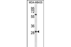 SLF8 Antibody (C-term) (ABIN656795 and ABIN2846014) western blot analysis in MDA-M cell line lysates (35 μg/lane).