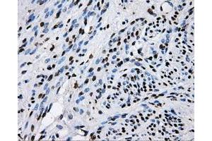 Immunohistochemical staining of paraffin-embedded endometrium tissue using anti-RALBP1mouse monoclonal antibody. (RALBP1 Antikörper)