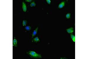 Immunofluorescent analysis of Hela cells using ABIN7160220 at dilution of 1:100 and Alexa Fluor 488-congugated AffiniPure Goat Anti-Rabbit IgG(H+L) (SMAD1 Antikörper  (AA 150-250))