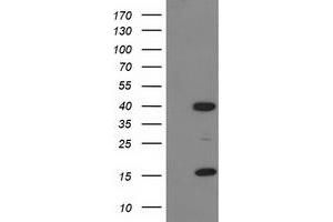 Western Blotting (WB) image for anti-PDZ and LIM Domain 2 (PDLIM2) antibody (ABIN1500126) (PDLIM2 Antikörper)