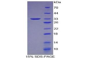 SDS-PAGE (SDS) image for Neural Cell Adhesion Molecule 1 (NCAM1) (AA 340-608) protein (His tag,T7 tag) (ABIN2126037)