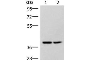 Western blot analysis of Hela and 231 cell lysates using HPDL Polyclonal Antibody at dilution of 1:400 (HPDL Antikörper)