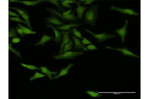 Immunofluorescence of purified MaxPab antibody to TRAF4 on HeLa cell.
