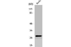 Western Blot analysis of COLO205 cells using Six3/6 Polyclonal Antibody