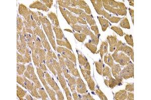 Immunohistochemistry of paraffin-embedded Mouse heart using GLUT4 Polyclonal Antibody at dilution of 1:100 (40x lens). (GLUT4 Antikörper)