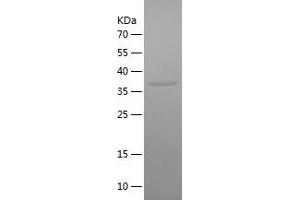 Western Blotting (WB) image for Odontogenic, Ameloblast Asssociated (ODAM) (AA 1-153) protein (His-IF2DI Tag) (ABIN7124252) (ODAM Protein (AA 1-153) (His-IF2DI Tag))