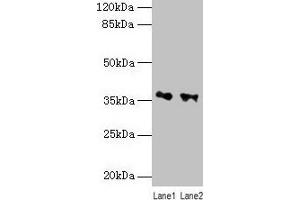 Western blot All lanes: RDH11 antibody at 10 μg/mL Lane 1: PC-3 whole cell lysate Lane 2: Hela whole cell lysate Secondary Goat polyclonal to rabbit IgG at 1/10000 dilution Predicted band size: 36, 35, 28 kDa Observed band size: 36 kDa (RDH11 Antikörper  (AA 22-318))
