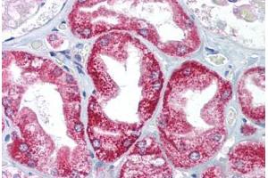 Human Kidney (formalin-fixed, paraffin-embedded) stained with AIFM1 antibody ABIN214083 at 5 ug/ml followed by biotinylated goat anti-rabbit IgG secondary antibody ABIN481713, alkaline phosphatase-streptavidin and chromogen. (AIF Antikörper  (AA 211-260))