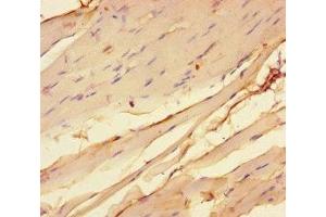 Immunohistochemistry of paraffin-embedded human skeletal muscle tissue using ABIN7142955 at dilution of 1:100 (CHRNA1 Antikörper  (AA 21-255))