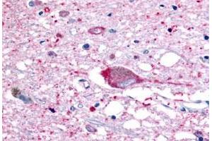 Immunohistochemistry (Formalin/PFA-fixed paraffin-embedded sections) of human brain, neurons and glia with GPR32 polyclonal antibody . (GPR32 Antikörper  (2nd Extracellular Domain))