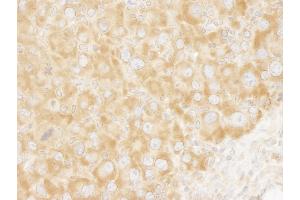 Immunohistochemistry (IHC) image for anti-Eukaryotic Translation Initiation Factor 3 Subunit A (EIF3A) (AA 860-910) antibody (ABIN7448546) (EIF3A Antikörper  (AA 860-910))