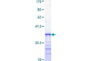 Image no. 1 for Hypoxia Inducible Factor 1, alpha Subunit (Basic Helix-Loop-Helix Transcription Factor) (HIF1A) (AA 717-826) protein (GST tag) (ABIN1306620)