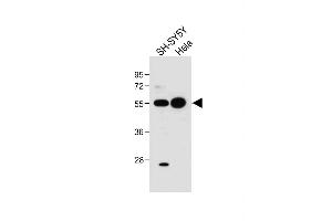 All lanes : Anti-hG5L-D3 at 1:1000 dilution Lane 1: SH-SY5Y whole cell lysate Lane 2: Hela whole cell lysate Lysates/proteins at 20 μg per lane. (ATG5 Antikörper  (N-Term))