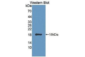 Figure. (Biliverdin Reductase Antikörper  (AA 1-125))