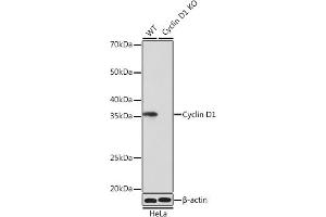 Western blot analysis of extracts from wild type (WT) and Cyclin D1 knockout (KO) HeLa cells, using Cyclin D1 antibody (ABIN7266561) at 1:1000 dilution.