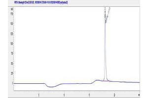 Image no. 2 for Adrenergic, beta-2-, Receptor, Surface (ADRB2) peptide (Ovalbumin) (ABIN5666062) (Adrenergic, beta-2-, Receptor, Surface (ADRB2) peptide (Ovalbumin))